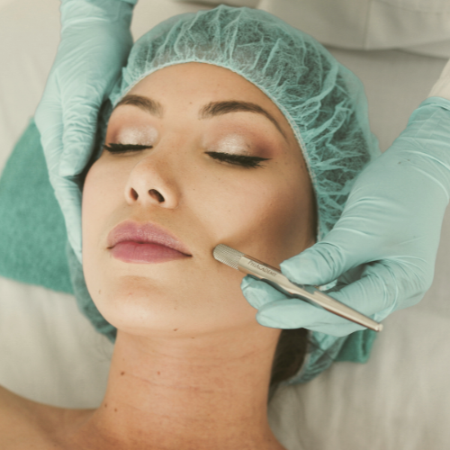 Microneedling Renewal